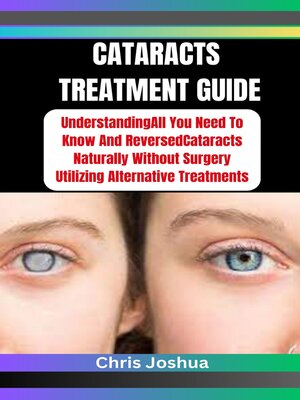 cover image of CATARACTS TREATMENT GUIDE